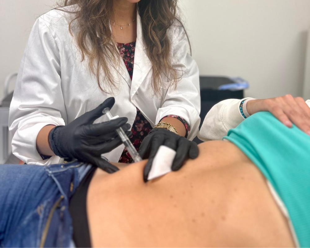 mesoterapia 